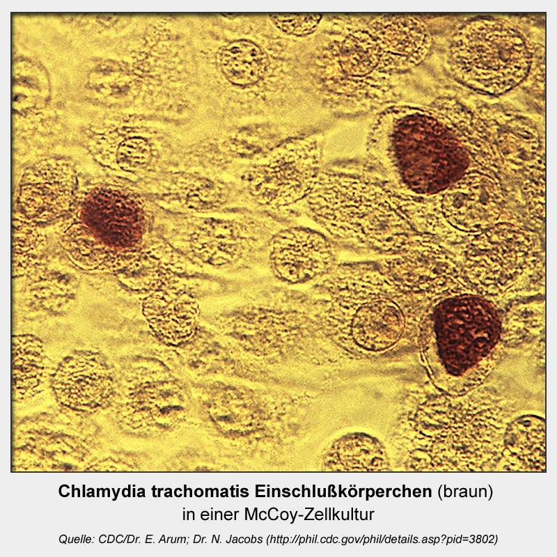 chlamydia trachomatis