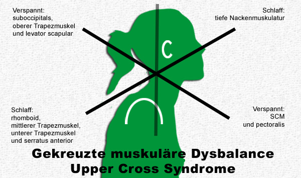 Upper Cross Syndrome