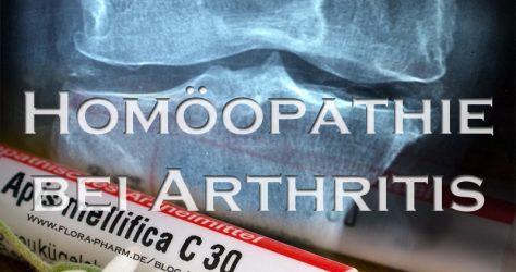 Homöopathie bei Arthritis