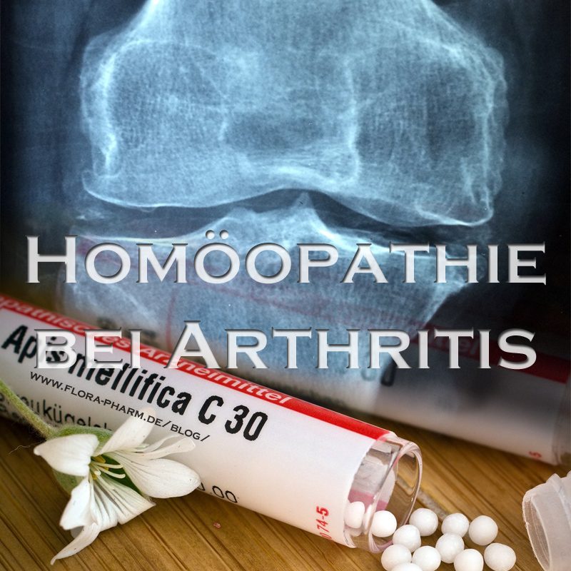 Homöopathie bei Arthritis