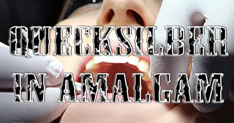 Quecksilber in Amalgam