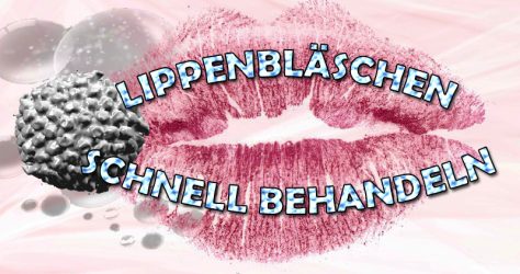 Herpes Lippenbläschen