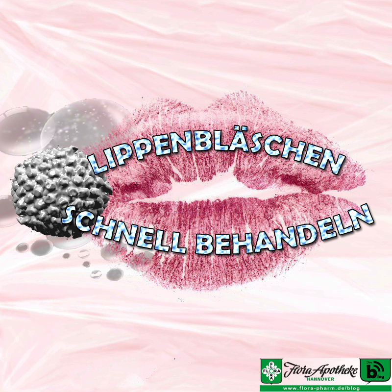 Schone Stress Blaschen Lippe Kein Herpes Bildernull