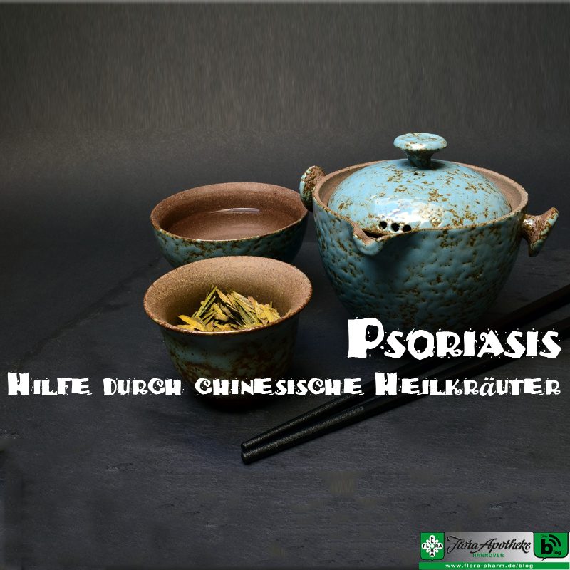 Psoriasis Schuppenflechte - Traditionelle Chinesische Medizin