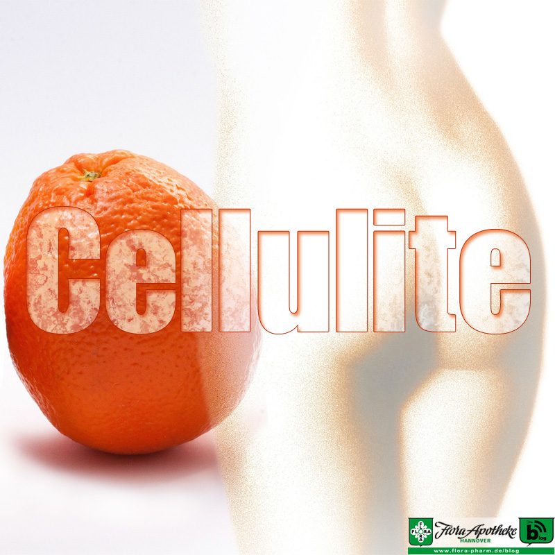 Cellulite