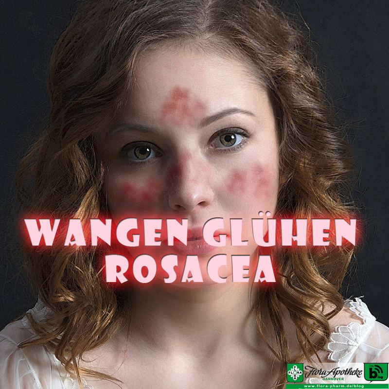 Rosacea - glühende Wangen