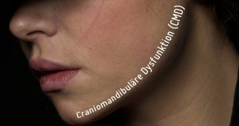 CMD (Craniomandibuläre Dysfunktion)