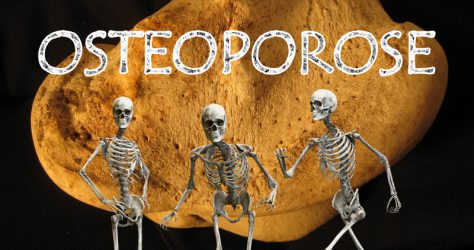 Osteoporose