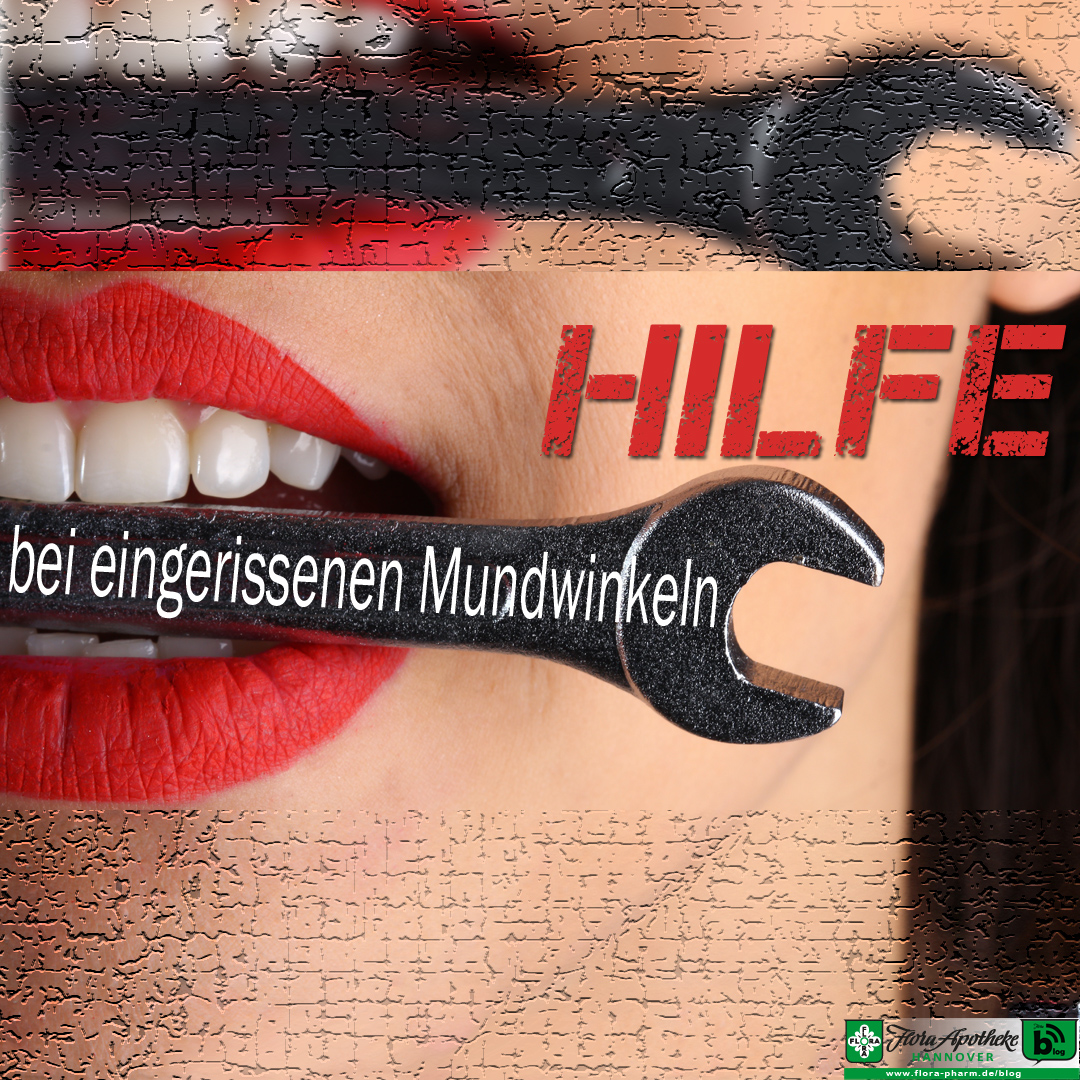 eingerissene mundwinkel hilfe