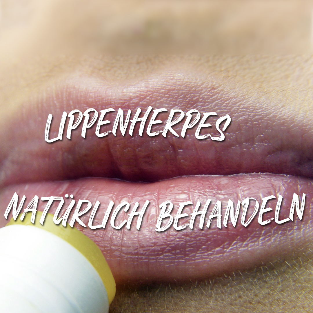 Lippenherpes natürlich behandeln - Expertenrat