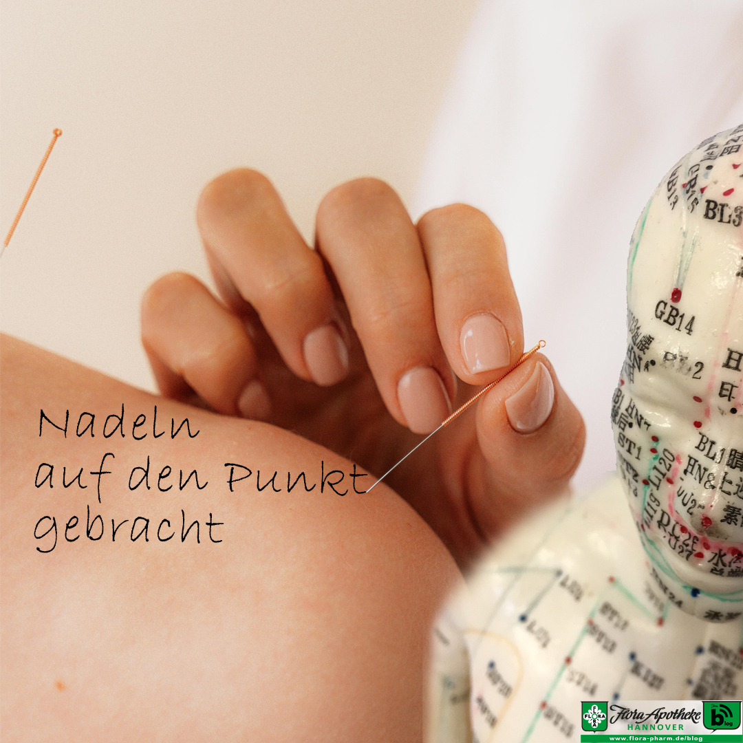 Akupunktur - Nadelstechen - bringt es auf den Punkt